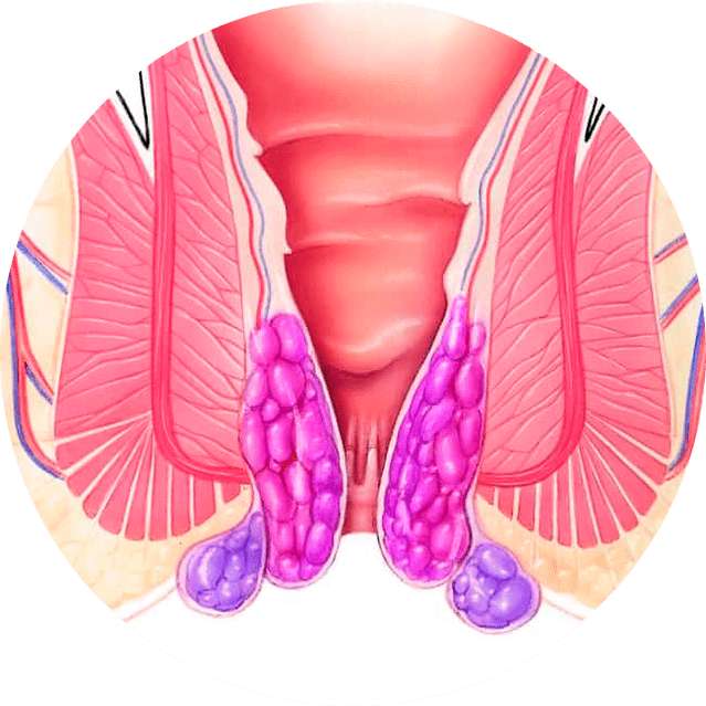 Gelarex zmierňuje príznaky už od prvého použitia